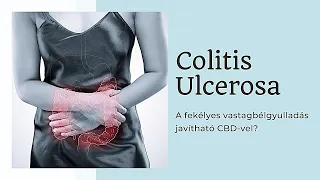 Colitis Ulcerosa - a fekélyes vastagbélgyulladás javítható CBD vel?