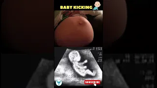 Baby Kicking in Mother's Belly | Baby kick | Pregnancy Motivation #pregnancy #shorts