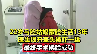 22岁马脸姑娘蒙脸生活13年，医生揭开盖头被吓一跳，最终手术换脸成功