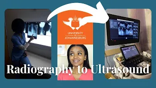 Why I’m leaving radiography for ultrasound | Radiologist vs radiographer