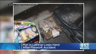 Lathrop Man Loses Hand In Firework Mishap