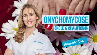 Les onychomycoses, des champignons dans les ongles, comment les soigner ? #DermatoDrey