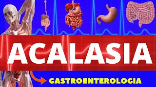 ACALASIA - O QUE É, CAUSAS, SINTOMAS, DIAGNÓSTICO E TRATAMENTO - FISIOPATOLOGIA - GASTROENTEROLOGIA