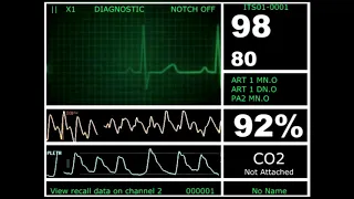 Hospital Monitor (HD)