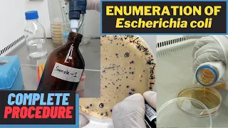 Enumeration of Escherichia coli (Total E. coli Count)_A Complete Procedure (ISO 9308-1 & ISO 16649)