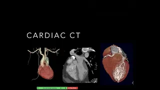 Noninvasive Cardiac Imaging