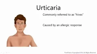 Urticaria