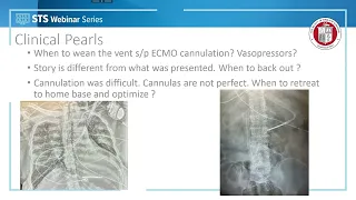 Dos and Don'ts of the Mobile ECMO Team (March 3, 2022)