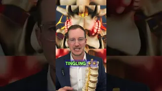 Bone spurs on the spine- Did you know this!?