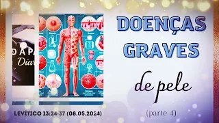 DOENÇAS GRAVES DE PELE (parte 4) || Levítico 13:24-37 || 08.05.2024