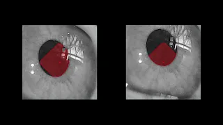 Pupil Detection on Images | OST Studienarbeit 2023