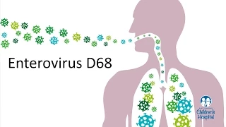 Enterovirus D68 - Pediatric Expert Tips