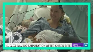 'She’s embracing it': Florida teen will have leg amputated after shark attack