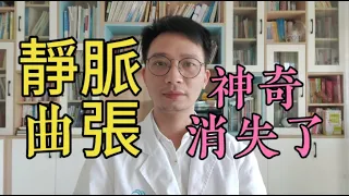 人老腿先老！下肢靜脈曲張4招預防，靜脈曲張消失了！功效太神奇，預防血管堵塞