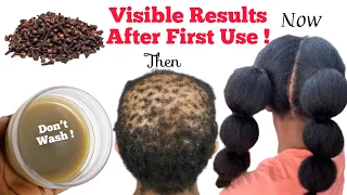How I Used This DIY Magic Grease For Extreme Hair Growth And Thickness