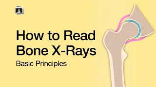 How to Read Bone X-Rays