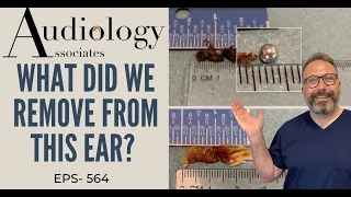 WHAT DID WE REMOVE FROM THIS EAR? - EP564