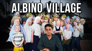 Visiting the Secret Albino Village in Tanzania (Too White to Live)