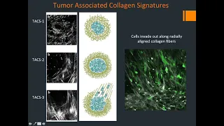 Multiphoton | In Vivo Imaging of the Tumor Microenvironment of Breast Cancer | Bruker