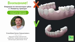 Только в декабре АКЦИЯ в Dent-Lux на импланты!