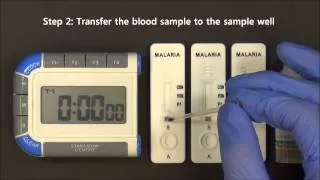 CareStart™ Malaria HRP2 / pLDH (Pf / VOM) video instruction (Access Bio, Inc.)