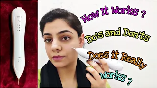 How to Remove Moles Using A Mole Remover Pen | Get Rid Of Moles at Home with this Product Instantly