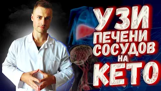 УЗИ печени и сосудов на КЕТО