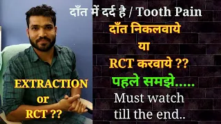 Extraction or RCT ?? Cost comparison, duration, changes after extraction |