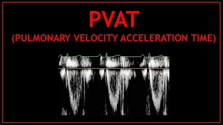 Pulmonary Velocity Acceleration Time (PVAT)! - Echocardiography