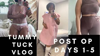 My Abdominoplasty journey. Days 1-5:  post surgery pics + My Mother’s Day