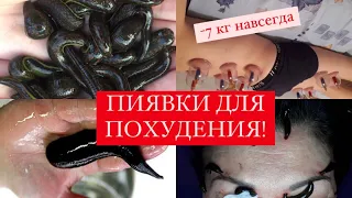 ПИЯВКИ 🤯🤭 ГЕРУДОТЕРАПИЯ ДЛЯ ПОХУДЕНИЯ 😮/ОБУЧЕНИЕ 💉👌🏽❤️