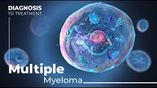 Unraveling Multiple Myeloma: From Causes to Treatment