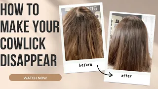 MAKE YOUR COWLICKS DISAPPEAR - Stop struggling with separations and TRY THIS!- hair tutorial