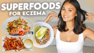 Eczema Diet: What to Eat for Clear Skin!