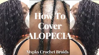 How To Cover Alopecia | Step By Step | Ms. Pk's Crochet Braids | Tutorial 4