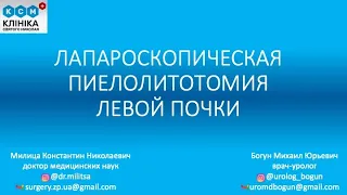 Лапароскопическая пиелолитотомия левой почки|Удаление коралловидного камня с разрезами лишь до 1 см!