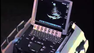 How to: Ultrasound FAST Exam - Right Upper Quadrant (RUQ)