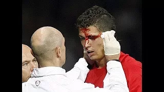 Cristiano  Ronaldo Top 3 worst injuries of whole football career