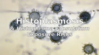 Histoplasmosis and Histoplasma capsulatum Exposure Risks