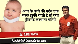 Torticollis Treatment In Hindi | Twisted Neck (Torticollis) क्या है | Treatment of Torticollis