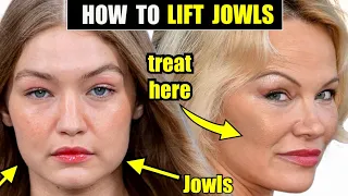 How to Lift & Tighten the Jowls with Sculptra-FDA Proven to Tighten Skin & Improve Jawline Contour!