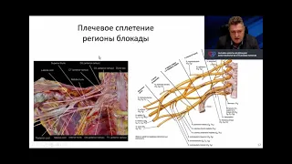 Блокада плечевого сплетения