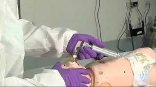 ATLS Intubacion orotraqueal pediatrica