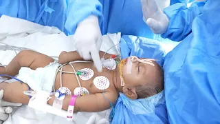 Doctors waking up a Baby after Anesthesia