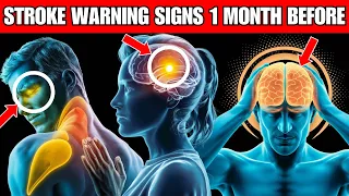 7 Stroke Symptoms 1 Month Before It Happens (Saving Lives with Early Detection)