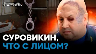 Суровикину "ПОДМЯЛИ ЛИЦО"? Куда упекли горе-генерала | Скальпель