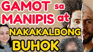 MANIPIS at Nakakalbong Buhok: Alamin ang Gagawin - Payo ni Doc Liza Ramoso-Ong #199