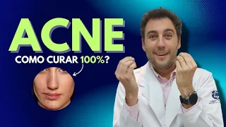 Como curar 100% da acne?