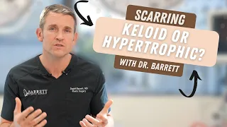 Keloid vs. Hypertrophic Scars!