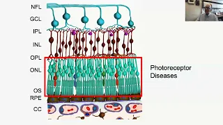 Lecture: Introduction to Inherited Retinal Disease